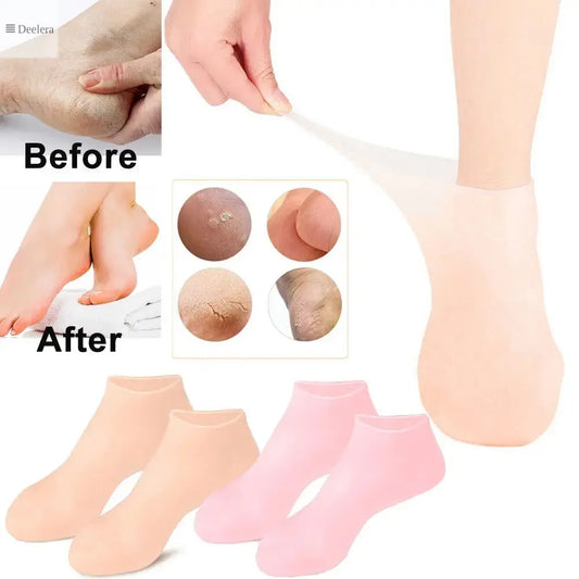 Moisturizing Silicone Socks for Dry, Cracked Heels – Hydrating Foot Care Solution Deelera